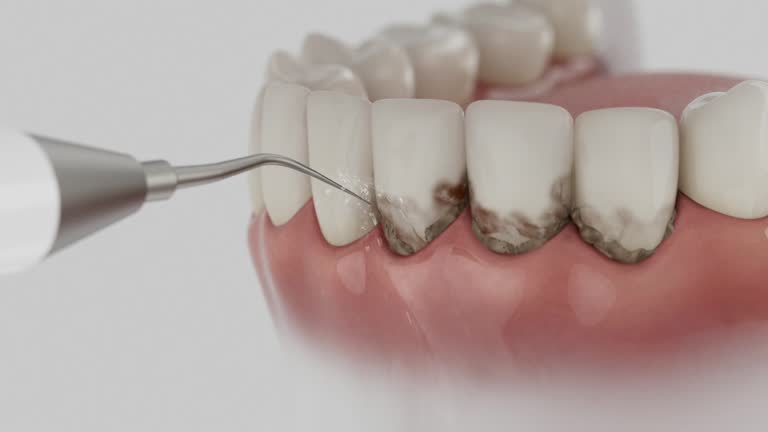Trusted Wisdom Tooth Removal service in Tabor City, NC - Dentist Open Now